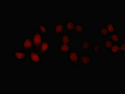 Immunofluorescent analysis of A549 cells using FBXL18 Antibody at dilution of 1:100 and Cy3-congugated Goat Anti-Rabbit IgGRabbit anti-Human FBXL18 Polyclonal Antibody