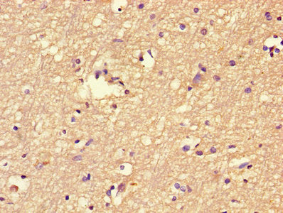 Immunohistochemistry of paraffin-embedded human brain tissue using the antibody at dilution of 1:100Rabbit anti-Human FBXL18 Polyclonal Antibody