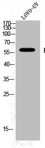 Western Blot analysis of LOVO+UV cells using Phospho-Fyn (Y530) Polyclonal AntibodyRabbit anti-Human Phospho-FYN (Y530) Polyclonal Antibody