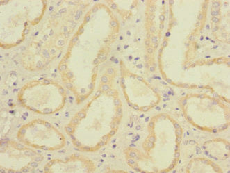 Immunohistochemistry of paraffin-embedded human kidney tissue using FCGR2C Antibody at dilution of 1:100Rabbit anti-Human FCGR2C Polyclonal Antibody