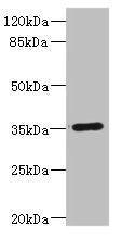 Western blot | All lanes: FCGR2C antibody IgG at 1.67μg/ml + Human Burkitt lymphoma cells | Secondary | Goat polyclonal to rabbit IgG at 1/10000 dilution | Predicted band size: 36, 31, 30, 26 kDa | Observed band size: 36 kDaRabbit anti-Human FCGR2C Polyclonal Antibody