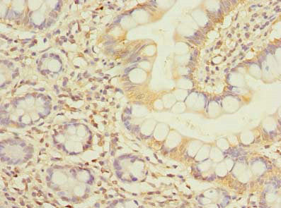 Immunohistochemistry of paraffin-embedded human small intestine tissue using FCHSD2 Antibody at dilution of 1:100Rabbit anti-Human FCHSD2 Polyclonal Antibody