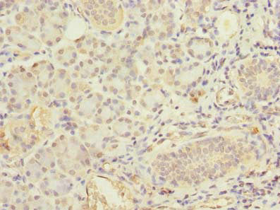 Immunohistochemistry of paraffin-embedded human pancreatic tissue using FCHSD2 Antibody at dilution of 1:100Rabbit anti-Human FCHSD2 Polyclonal Antibody