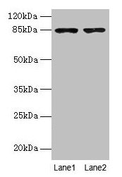 Western blot  | All lanes: FCHSD2 antibody at 12µg/ml  | Lane 1: U251 whole cell lysate  | Lane 2: A549 whole cell lysate  | Secondary  | Goat polyclonal to rabbit IgG at 1/10000 dilution  | Predicted band size: 85, 78, 59 kDa  | Observed band size: 85 kDaRabbit anti-Human FCHSD2 Polyclonal Antibody