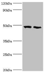 Western blot  | All lanes: FDFT1 antibody at 2µg/ml  | Lane 1: 293T whole cell lysate  | Lane 2: Mouse liver tissue  | Secondary  | Goat polyclonal to rabbit IgG at 1/10000 dilution  | Predicted band size: 49, 41, 39, 36, 44 kDa  | Observed band size: 49 kDa