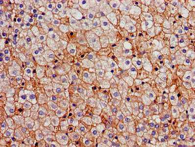 Immunohistochemistry of paraffin-embedded human adrenal gland tissue using FDFT1 Antibody at dilution of 1:100Rabbit anti-Human FDFT1 Polyclonal Antibody