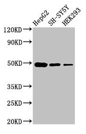 Western Blot  | Positive WB detected in: HepG2 whole cell lysate, SH-SY5Y whole cell lysate, HEK293 whole cell lysate  | All lanes: FDFT1 antibody at 3µg/ml  | Secondary  | Goat polyclonal to rabbit IgG at 1/50000 dilution  | Predicted band size: 49, 41, 39, 36, 44 kDa  | Observed band size: 49 kDaRabbit anti-Human FDFT1 Polyclonal Antibody
