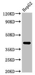 Western Blot  | Positive WB detected in: HepG2 whole cell lysate  | All lanes: FDPS antibody at 3µg/ml  | Secondary  | Goat polyclonal to rabbit IgG at 1/50000 dilution  | Predicted band size: 49, 41 kDa  | Observed band size: 41 kDaRabbit anti-Human FDPS Polyclonal Antibody