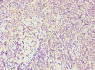 Immunohistochemistry of paraffin-embedded human tonsil tissue using the antibody at dilution of 1:100Rabbit anti-Human FES Polyclonal Antibody