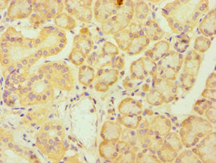 Immunohistochemistry of paraffin-embedded human pancreatic tissue using FES Antibody at dilution of 1:100Rabbit anti-Human FES Polyclonal Antibody