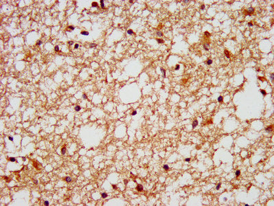 IHC image of the antibody diluted at 1:400 and staining in paraffin-embedded human brain tissue performed on a Leica BondTM system. After dewaxing and hydration, antigen retrieval was mediated by high pressure in a citrate buffer (pH 6.0). Section was blocked with 10% normal goat serum 30min at RT. Then primary antibody (1% BSA) was incubated at 4°C overnight. The primary is detected by a biotinylated secondary antibody and visualized using an HRP conjugated SP system.Rabbit anti-Human FFAR1 Polyclonal Antibody