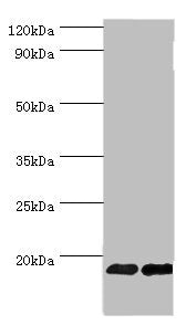 Western blot | All lanes: Fibroblast growth factor 1 antibody at 6μg/ml | Lane 1: Mouse kidney tissue | Lane 2: Mouse heart tissue | Secondary | Goat polyclonal to rabbit IgG at 1/10000 dilution | Predicted band size: 18, 7 kDa | Observed band size: 18 kDaRabbit anti-Human FGF1 Polyclonal Antibody