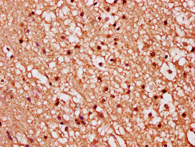 IHC image of FGF1 Antibody diluted at 1:289 and staining in paraffin-embedded human brain tissue performed on a Leica BondTM system. After dewaxing and hydration, antigen retrieval was mediated by high pressure in a citrate buffer (pH 6.0). Section was blocked with 10% normal goat serum 30min at RT. Then primary antibody (1% BSA) was incubated at 4°C overnight. The primary is detected by a biotinylated secondary antibody and visualized using an HRP conjugated SP system.Rabbit anti-Human FGF1 Polyclonal Antibody