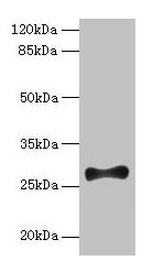Western blot  | All lanes: FGF13 antibody at 12µg/ml + Mouse brain tissue  | Secondary  | Goat polyclonal to rabbit IgG at 1/10000 dilution  | Predicted band size: 28, 22, 29, 23, 26 kDa  | Observed band size: 28 kDaRabbit anti-Human FGF13 Polyclonal Antibody