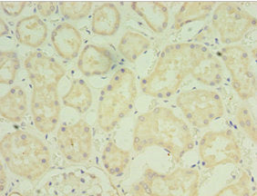 Immunohistochemistry of paraffin-embedded human kidney tissue using FGF6 Antibody at dilution of 1:100Rabbit anti-Human FGF6 Polyclonal Antibody