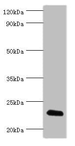 Western blot | All lanes: FGF6 antibody at 10μg/ml + HepG2 whole cell lysate | Secondary | Goat polyclonal to rabbit IgG at 1/10000 dilution | Predicted band size: 23 kDa | Observed band size: 23 kDaRabbit anti-Human FGF6 Polyclonal Antibody