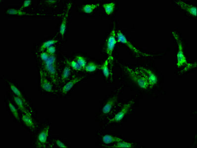 Immunofluorescence staining of Hela cells with FGFR3 Antibody at 1:150, counter-stained with DAPI. The cells were fixed in 4% formaldehyde, permeabilized using 0.2% Triton X-100 and blocked in 10% normal Goat Serum. The cells were then incubated with the antibody overnight at 4°C. The secondary antibody was Alexa Fluor 488-congugated AffiniPure Goat Anti-Rabbit IgG(H+L).Rabbit anti-Human FGFR3 Polyclonal Antibody