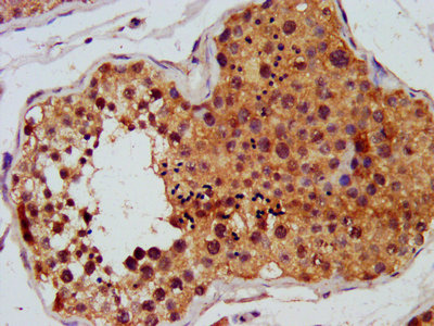 IHC image of the antibody diluted at 1:450 and staining in paraffin-embedded human testis tissue performed on a Leica BondTM system. After dewaxing and hydration, antigen retrieval was mediated by high pressure in a citrate buffer (pH 6.0). Section was blocked with 10% normal goat serum 30min at RT. Then primary antibody (1% BSA) was incubated at 4°C overnight. The primary is detected by a biotinylated secondary antibody and visualized using an HRP conjugated SP system.Rabbit anti-Human FGFR3 Polyclonal Antibody