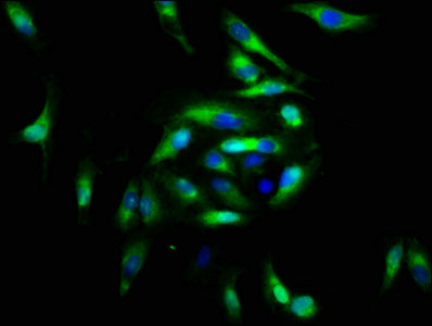 Immunofluorescence staining of Hela cells with FGFRL1 Antibody at 1:166, counter-stained with DAPI. The cells were fixed in 4% formaldehyde, permeabilized using 0.2% Triton X-100 and blocked in 10% normal Goat Serum. The cells were then incubated with the antibody overnight at 4°C. The secondary antibody was Alexa Fluor 488-congugated AffiniPure Goat Anti-Rabbit IgG(H+L).Rabbit anti-Human FGFRL1 Polyclonal Antibody