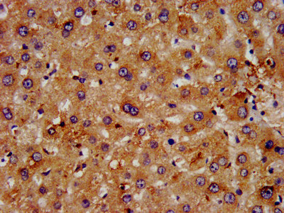 IHC image of FGFRL1 Antibody diluted at 1:500 and staining in paraffin-embedded human liver tissue performed on a Leica BondTM system. After dewaxing and hydration, antigen retrieval was mediated by high pressure in a citrate buffer (pH 6.0). Section was blocked with 10% normal goat serum 30min at RT. Then primary antibody (1% BSA) was incubated at 4°C overnight. The primary is detected by a biotinylated secondary antibody and visualized using an HRP conjugated SP system.Rabbit anti-Human FGFRL1 Polyclonal Antibody