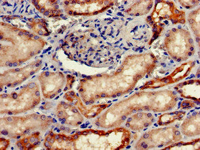 Immunohistochemistry of paraffin-embedded human kidney tissue using the antibody at dilution of 1:100Rabbit anti-Human FGG Polyclonal Antibody