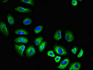 Immunofluorescent analysis of A549 cells using FGR Antibody at dilution of 1:100 and Alexa Fluor 488-congugated AffiniPure Goat Anti-Rabbit IgG(H+L)Rabbit anti-Human FGR Polyclonal Antibody