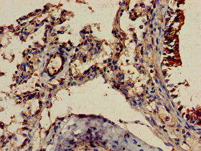 Immunohistochemistry of paraffin-embedded human lung tissue using the antibody at dilution of 1:100Rabbit anti-Human FGR Polyclonal Antibody