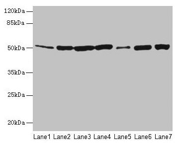 Western blot  | All lanes: FH antibody at 12µg/ml  | Lane 1: Mouse heart tissue  | Lane 2: Mouse liver tissue  | Lane 3: Mouse kidney tissue  | Lane 4: Mouse brain tissue  | Lane 5: Human placenta tissue  | Lane 6: Hela whole cell lysate  | Lane 7: HepG2 whole cell lysate  | Secondary  | Goat polyclonal to rabbit IgG at 1/10000 dilution  | Predicted band size: 55, 51 kDa  | Observed band size: 51 kDaRabbit anti-Human FH Polyclonal Antibody
