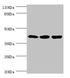 Western blot | All lanes: FIBP antibody at 1.84μg/ml | Lane 1: Rat gonad tissue | Lane 2: MCF-7 whole cell lysate | Lane 3: Mouse skeletal muscle tissue | Secondary | Goat polyclonal to rabbit IgG at 1/10000 dilution | Predicted band size: 42 kDa | Observed band size: 42 kDaRabbit anti-Human FIBP Polyclonal Antibody