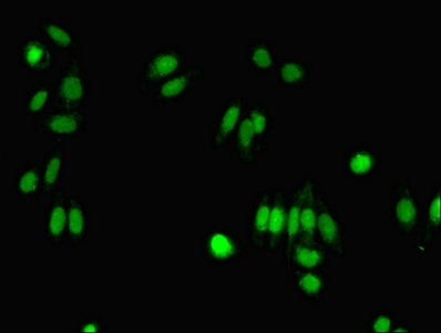 Immunofluorescent analysis of HepG2 cells using FIBP Antibody at dilution of 1:100 and Alexa Fluor 488-congugated AffiniPure Goat Anti-Rabbit IgG(H+L)Rabbit anti-Human FIBP Polyclonal Antibody