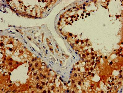Immunohistochemistry of paraffin-embedded human testis tissue using FIBP Antibody at dilution of 1:100Rabbit anti-Human FIBP Polyclonal Antibody