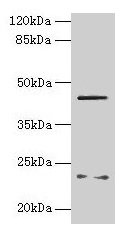 Western blot  | All lanes: FIBP antibody at 6µg/ml + MCF-7 whole cell lysate  | Secondary  | Goat polyclonal to rabbit IgG at 1/10000 dilution  | Predicted band size: 42 kDa  | Observed band size: 42 kDaRabbit anti-Human FIBP Polyclonal Antibody