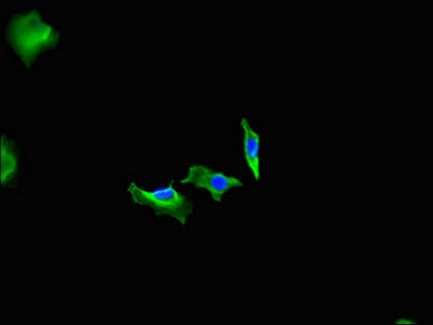 Immunofluorescent analysis of Hela cells using FIGN Antibody at dilution of 1:100 and Alexa Fluor 488-congugated AffiniPure Goat Anti-Rabbit IgG(H+L)Rabbit anti-Human FIGN Polyclonal Antibody