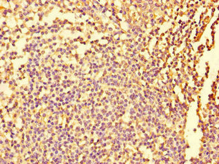 Immunohistochemistry of paraffin-embedded human tonsil tissue using the antibody at dilution of 1:100Rabbit anti-Human FIGN Polyclonal Antibody