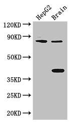 Western Blot | Positive WB detected in: HepG2 whole cell lysate, Mouse brain tissue | All lanes: FIGN antibody at 3μg/ml | Secondary | Goat polyclonal to rabbit IgG at 1/50000 dilution | Predicted band size: 83 kDa | Observed band size: 83, 38 kDaRabbit anti-Human FIGN Polyclonal Antibody