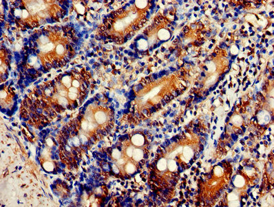 Immunohistochemistry of paraffin-embedded human small intestine tissue using FKBP3 Antibody at dilution of 1:100Rabbit anti-Human FKBP3 Polyclonal Antibody