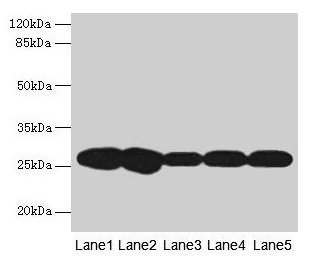 Western blot  | All lanes: FKBP3 antibody at 4µg/ml  | Lane 1: Hela whole cell lysate  | Lane 2: A431 whole cell lysate  | Lane 3: PC-3 whole cell lysate  | Lane 4: Jurkat whole cell lysate  | Lane 5: 293T whole cell lysate  | Secondary  | Goat polyclonal to rabbit IgG at 1/10000 dilution  | Predicted band size: 26 kDa  | Observed band size: 26 kDaRabbit anti-Human FKBP3 Polyclonal Antibody