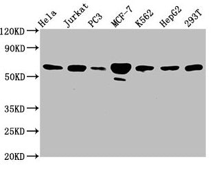 Western Blot  | Positive WB detected in: Hela whole cell lysate, Jurkat whole cell lysate, PC-3 whole cell lysate, MCF-7 whole cell lysate, K562 whole cell lysate, HepG2 whole cell lysate, 293T whole cell lysate  | All lanes: FKBP4 antibody at 3.3µg/ml  | Secondary  | Goat polyclonal to rabbit IgG at 1/50000 dilution  | Predicted band size: 52 kDa  | Observed band size: 59 kDaRabbit anti-Human FKBP4 Polyclonal Antibody