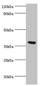 Western blot | All lanes: Peptidyl-prolyl cis-trans isomerase FKBP4 antibody at 0.5μg/ml + MCF-7 whole cell lysate | Secondary | Goat polyclonal to rabbit IgG at 1/10000 dilution | Predicted band size: 52 kDa | Observed band size: 52 kDaRabbit anti-Human FKBP4 Polyclonal Antibody