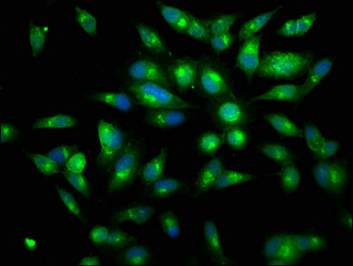 Immunofluorescence staining of Hela cells with LTF Antibody at 1:150, counter-stained with DAPI. The cells were fixed in 4% formaldehyde, permeabilized using 0.2% Triton X-100 and blocked in 10% normal Goat Serum. The cells were then incubated with the antibody overnight at 4°C. The secondary antibody was Alexa Fluor 488-congugated AffiniPure Goat Anti-Rabbit IgG(H+L).