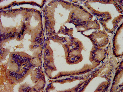IHC image of the antibody diluted at 1:450 and staining in paraffin-embedded human prostate tissue performed on a Leica BondTM system. After dewaxing and hydration, antigen retrieval was mediated by high pressure in a citrate buffer (pH 6.0). Section was blocked with 10% normal goat serum 30min at RT. Then primary antibody (1% BSA) was incubated at 4°C overnight. The primary is detected by a biotinylated secondary antibody and visualized using an HRP conjugated SP system.