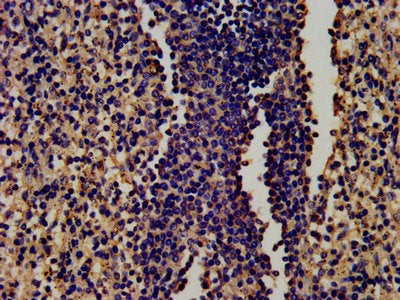 IHC image of LTF Antibody diluted at 1:450 and staining in paraffin-embedded human spleen tissue performed on a Leica BondTM system. After dewaxing and hydration, antigen retrieval was mediated by high pressure in a citrate buffer (pH 6.0). Section was blocked with 10% normal goat serum 30min at RT. Then primary antibody (1% BSA) was incubated at 4°C overnight. The primary is detected by a biotinylated secondary antibody and visualized using an HRP conjugated SP system.