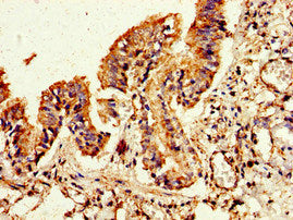 Immunohistochemistry of paraffin-embedded human lung tissue using FLI1 Antibody at dilution of 1:100Rabbit anti-Human FLI1 Polyclonal Antibody