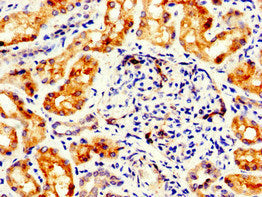 Immunohistochemistry of paraffin-embedded human kidney tissue using FLI1 Antibody at dilution of 1:100Rabbit anti-Human FLI1 Polyclonal Antibody