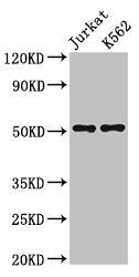 Western Blot  | Positive WB detected in: Jurkat whole cell lysate, K562 whole cell lysate  | All lanes: FLI1 antibody at 3µg/ml  | Secondary  | Goat polyclonal to rabbit IgG at 1/50000 dilution  | Predicted band size: 51, 44, 48, 30 kDa  | Observed band size: 51 kDaRabbit anti-Human FLI1 Polyclonal Antibody