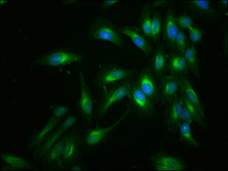 Immunofluorescent analysis of Hela cells using FLNA Antibody at dilution of 1:100 and Alexa Fluor 488-congugated AffiniPure Goat Anti-Rabbit IgG(H+L)Rabbit anti-Human FLNA Polyclonal Antibody