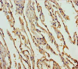 Immunohistochemistry of paraffin-embedded human lung tissue using FMO5 Antibody at dilution of 1:100Rabbit anti-Human FMO5 Polyclonal Antibody
