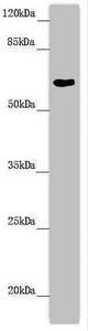 Western blot | All lanes: FMO5 antibody at 6.04 μg/ml + Mouse liver tissue | Secondary | Goat polyclonal to rabbit IgG at 1/10000 dilution | Predicted band size: 61, 33, 53 kDa | Observed band size: 61 kDaRabbit anti-Human FMO5 Polyclonal Antibody