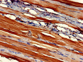 Immunohistochemistry of paraffin-embedded human skeletal muscle tissue using FMOD Antibody at dilution of 1:100Rabbit anti-Human FMOD Polyclonal Antibody