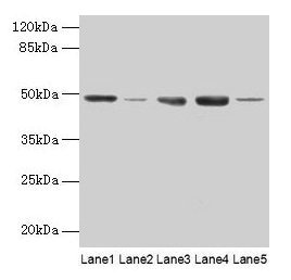 Western blot  | All lanes: FNTB antibody at 6µg/ml  | Lane 1: Hela whole cell lysate  | Lane 2: CEM whole cell lysate  | Lane 3: HepG2 whole cell lysate  | Lane 4: SH-SY5Y whole cell lysate  | Lane 5: A549 whole cell lysate  | Secondary  | Goat polyclonal to rabbit IgG at 1/10000 dilution  | Predicted band size: 49, 44 kDa  | Observed band size: 49 kDaRabbit anti-Human FNTB Polyclonal Antibody